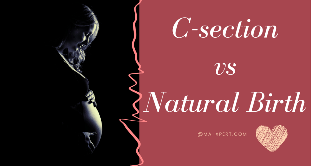 C section Vs Natural Birth 