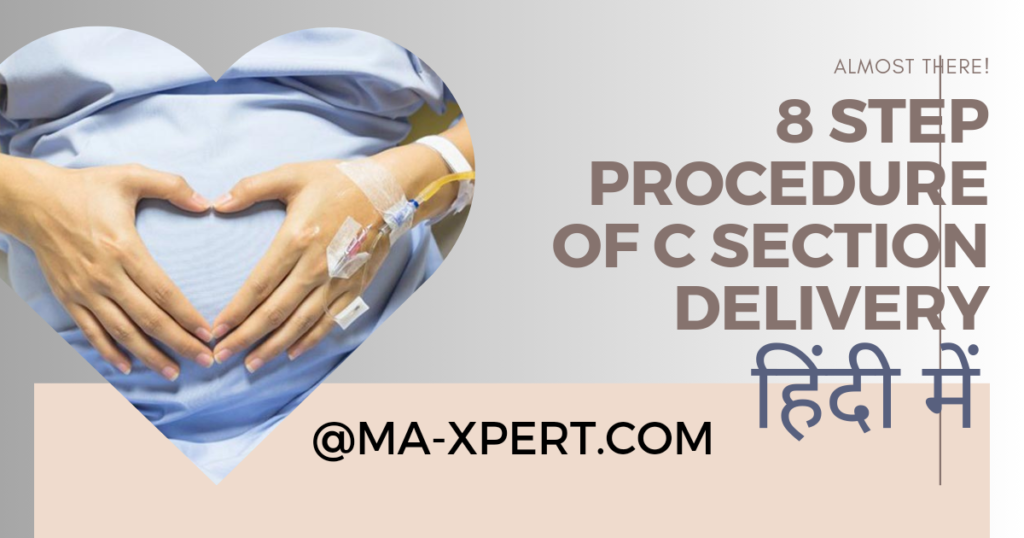 C section delivery in hindi